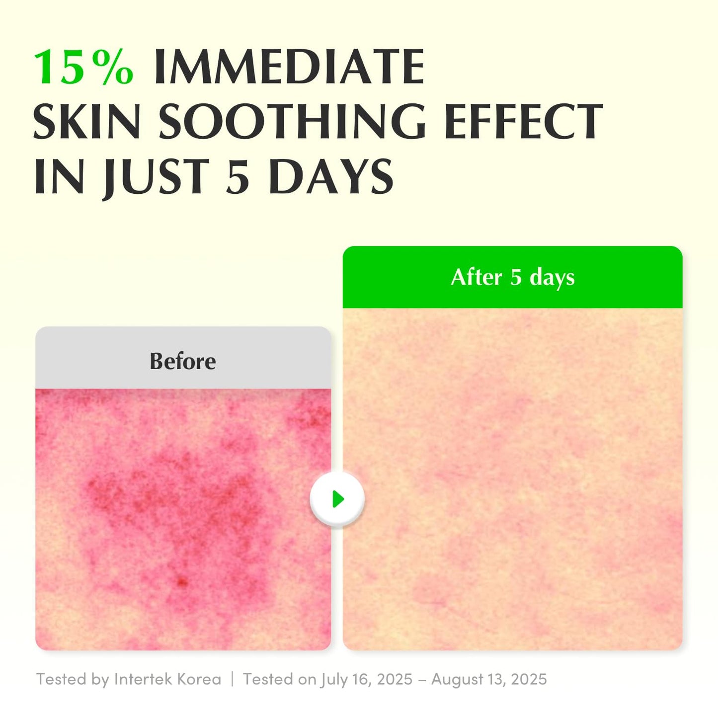 EQQUALBERRY Green Aid Aloe PDRN Calming Serum - Glam Secret