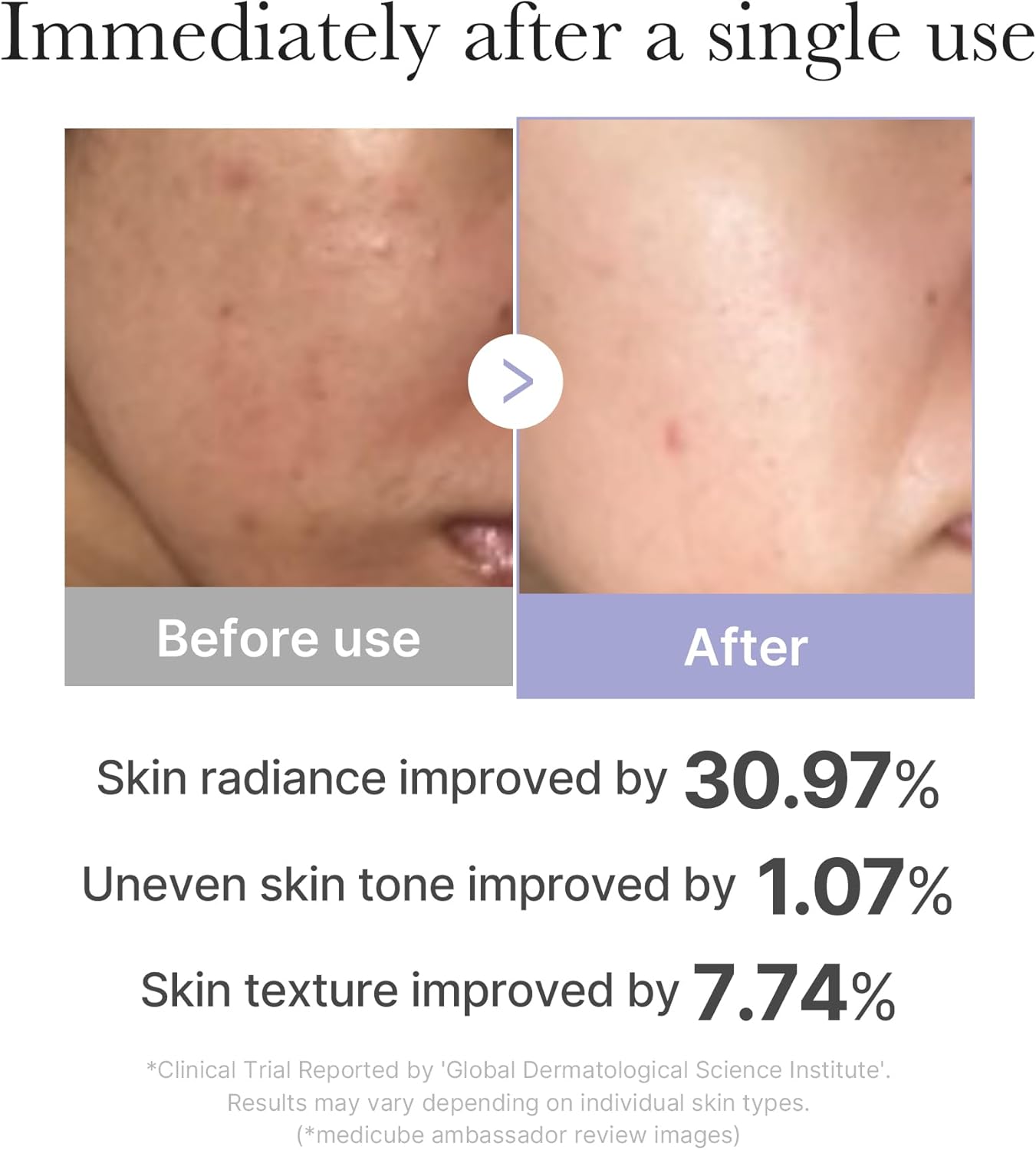 MEDICUBE Age R PRO Booster Mini - Glam Secret