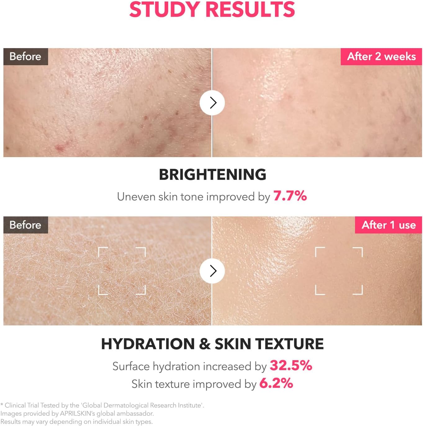 APRILSKIN TXA+Niacinamide 99 Pink Milky Toner