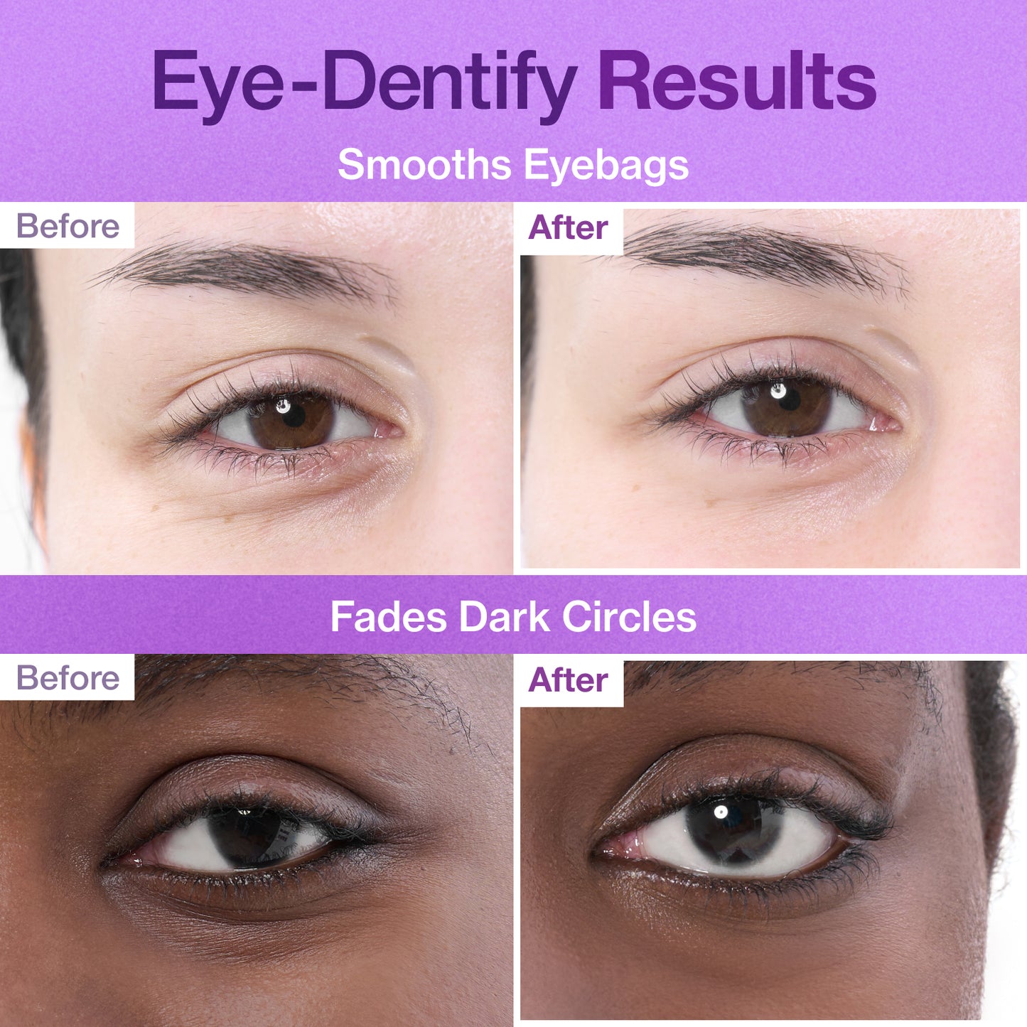 Numbuzin No.9 3Days Eye Care Kit