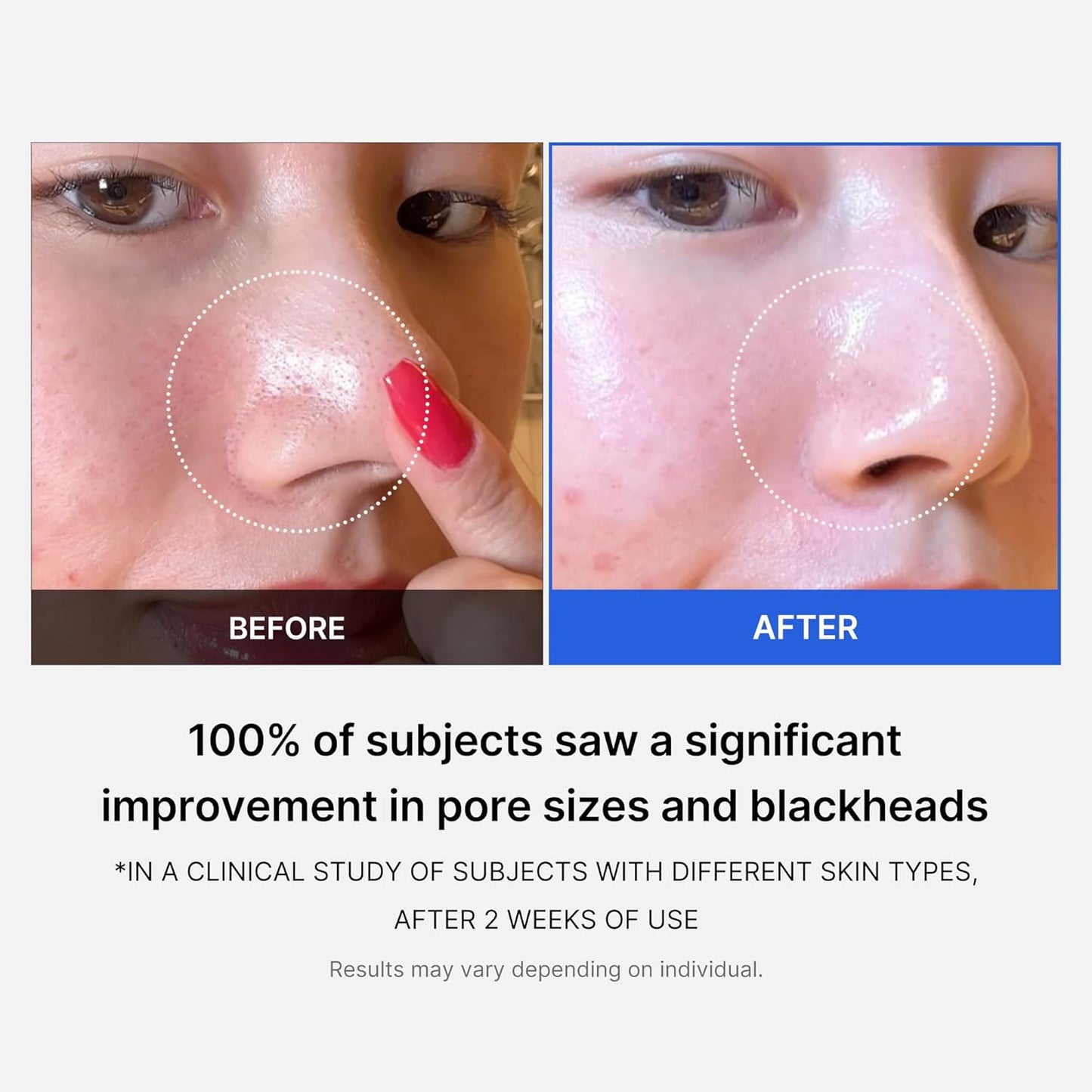 MEDICUBE Zero Pore Pad 155g - Glam Secret