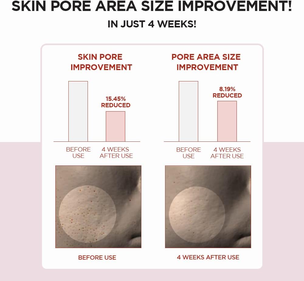 SKIN1004 Madagascar Centella Poremizing Clear TonerTonerGlam Secret