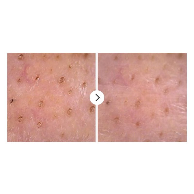 NUMBUZIN No.1 Easy Peasy Cleansing OilCleansing OilGlam Secret