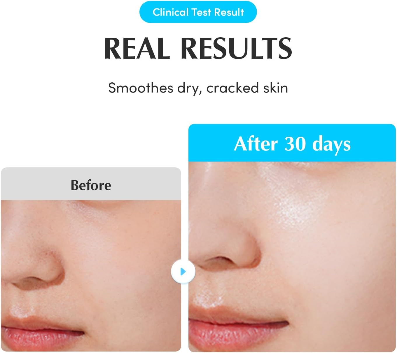 EQQUALBERRY Swimming Pool Ampoule 50ml - Glam Secret