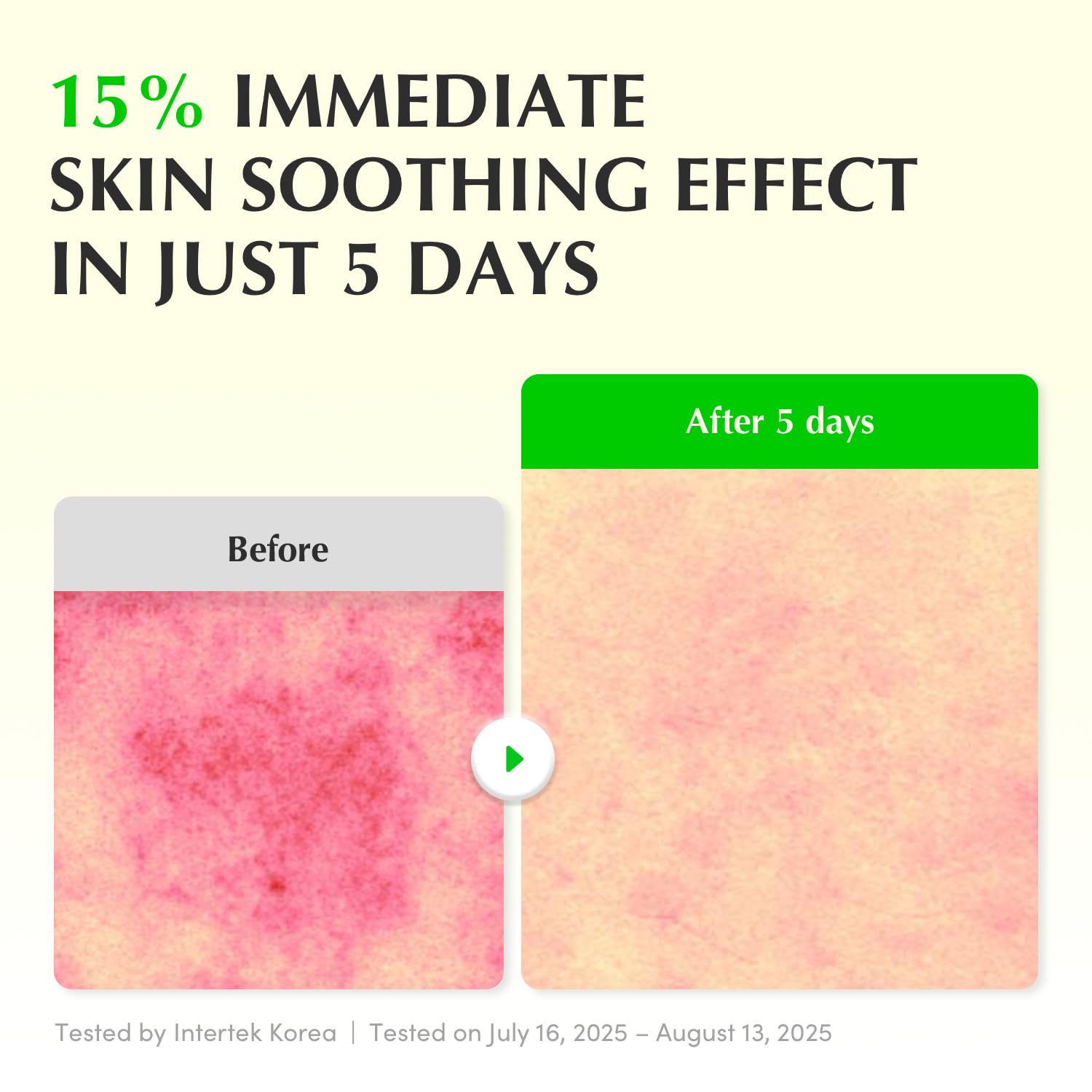 EQQUALBERRY Green Aid Aloe PDRN Calming Serum - Glam Secret