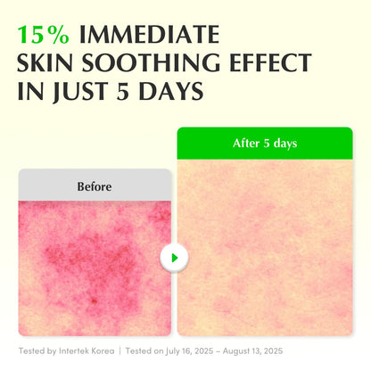 EQQUALBERRY Green Aid Aloe PDRN Calming Serum - Glam Secret