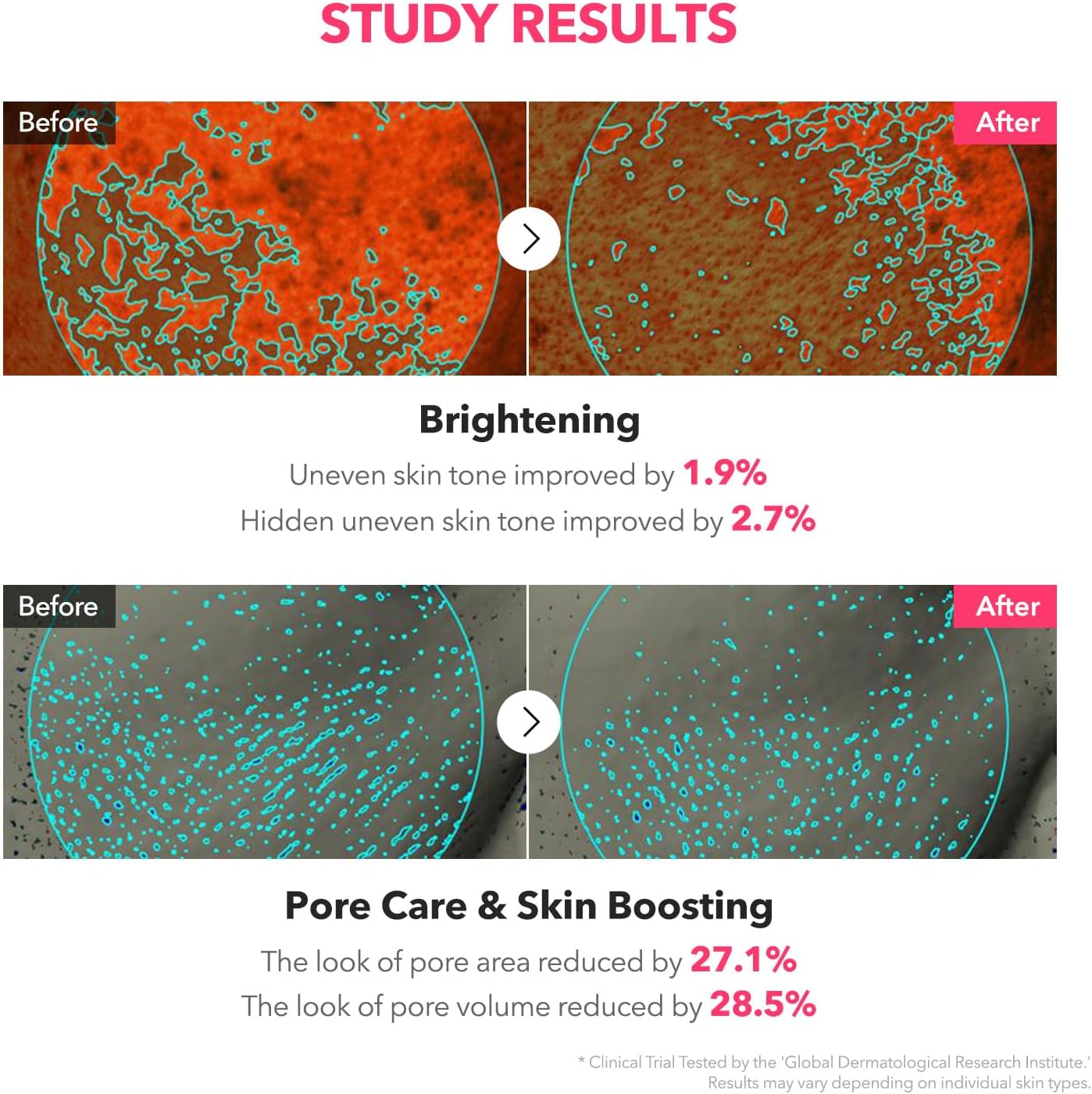 APRILSKIN TXA Niacinamide Toning Shot 99 Spicule Facial Serum