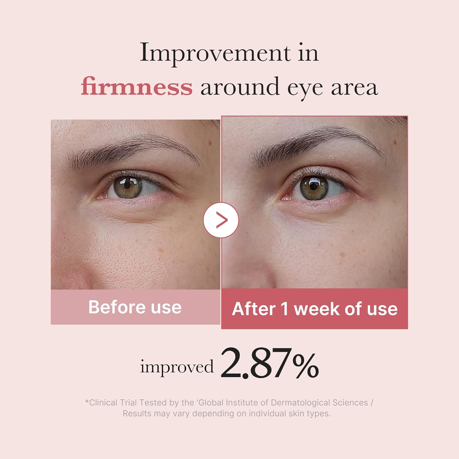 Medicube Salmon DNA PDRN Pink Peptide Eye Serum in a 30ml tube, featuring a creamy texture for eye area skincare.