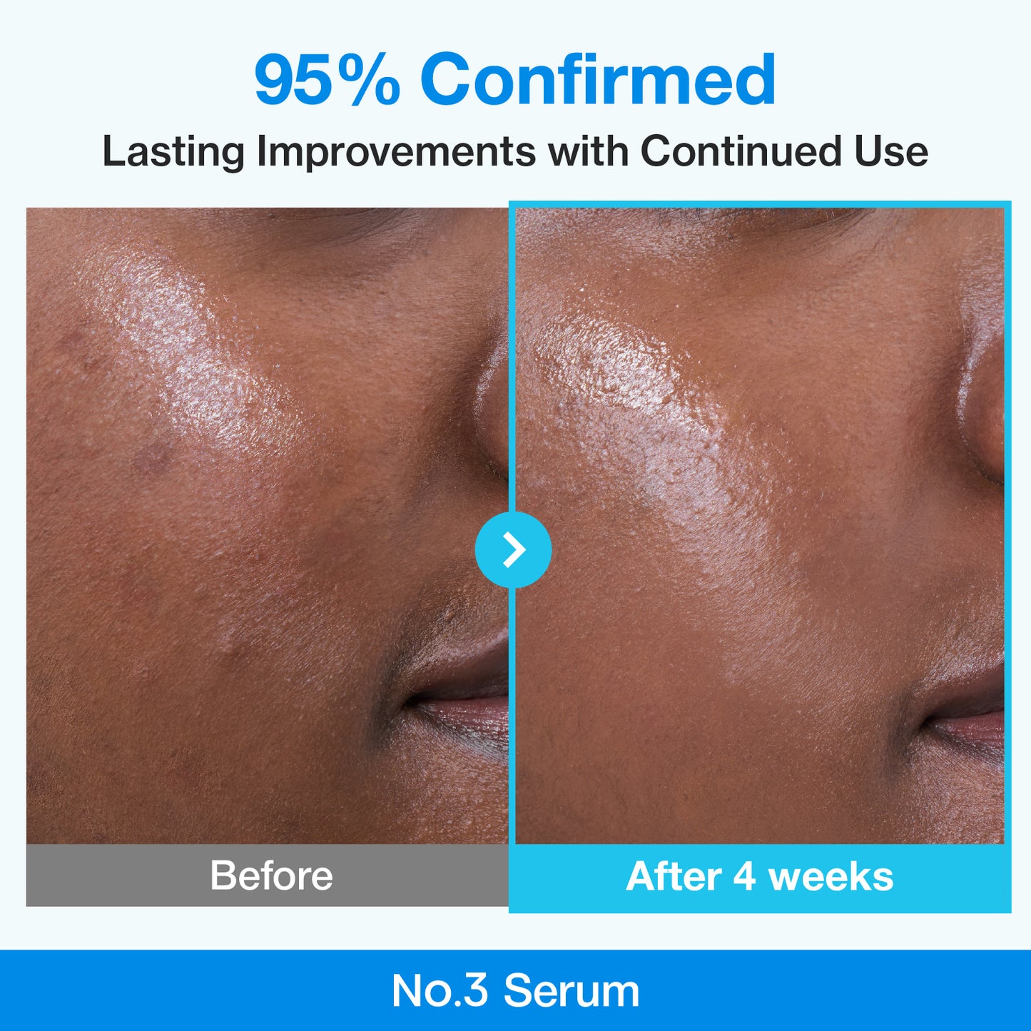 Beginner-friendly retinol serum for smoother skin 