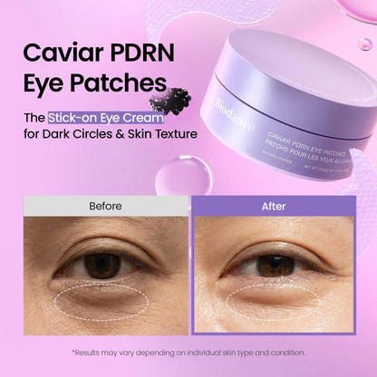 Caviar PDRN under eye patches for puffiness care 