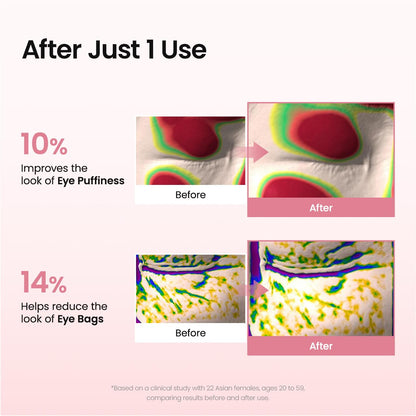 Collagen peptide under eye patches for puffy eyes 