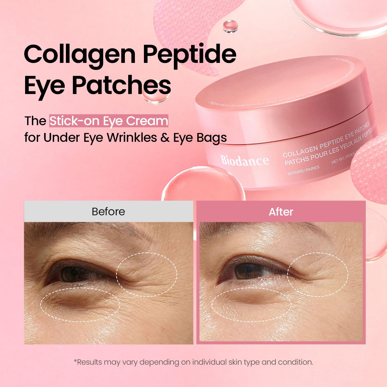 Collagen peptide under eye patches for puffy eyes collagen 