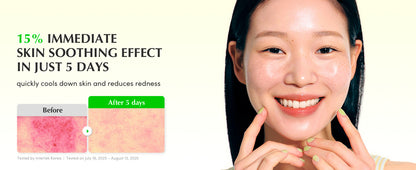 EQQUALBERRY Green Aid Aloe PDRN Calming Serum - Glam Secret