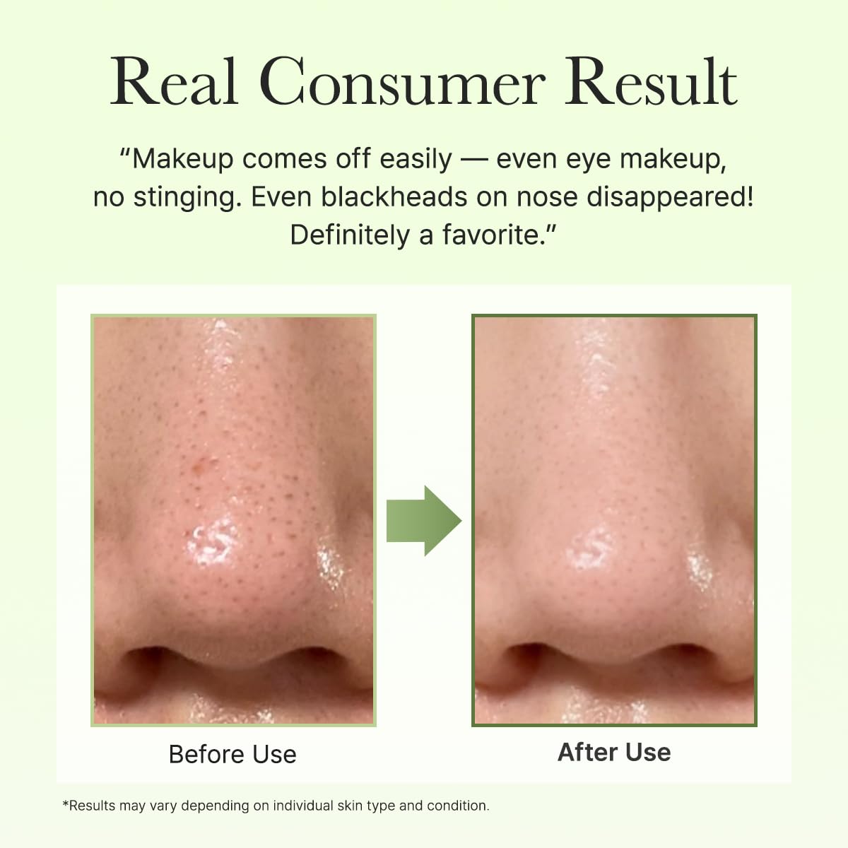 Korean balm cleanser for pore buildup and excess sebum
