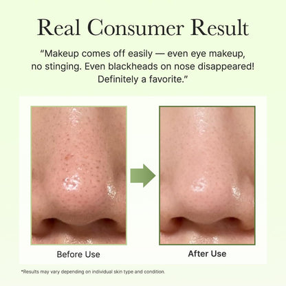 Korean balm cleanser for pore buildup and excess sebum