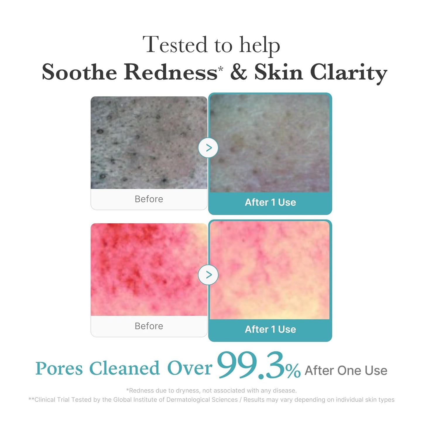 Korean cleanser for oily combination and blemish-prone skin 