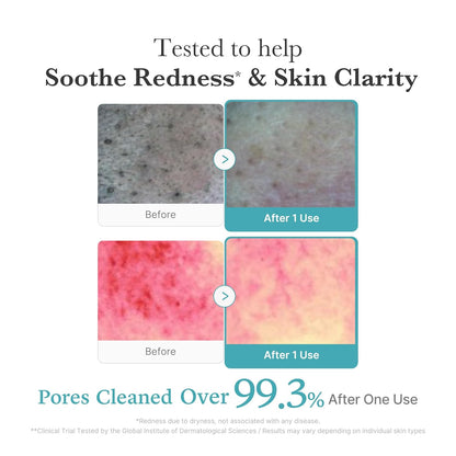 Korean cleanser for oily combination and blemish-prone skin 