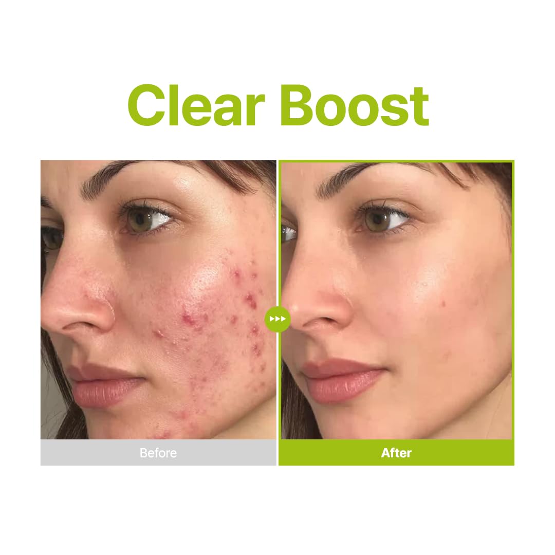 PURITO Kojic Tea Tree Serum for dark spots and blemishes