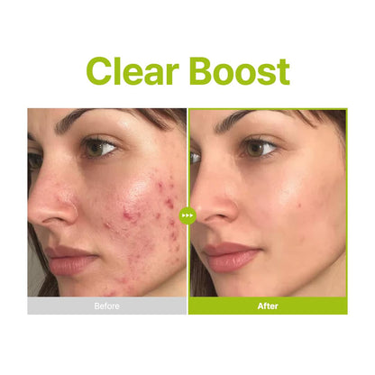 PURITO Kojic Tea Tree Serum for dark spots and blemishes