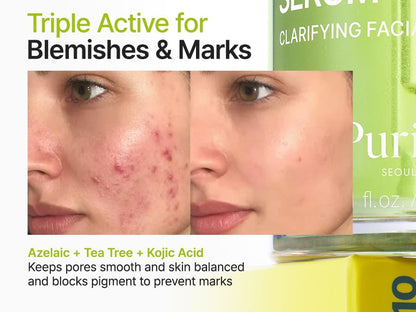 Purito Azelaic Acid 10% Kojic Teatree Face Serum in a 30ml bottle with dropper for skin brightening and blemish treatment 
