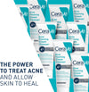 CERAVE Acne Foaming Cream Cleanser - Glam Secret