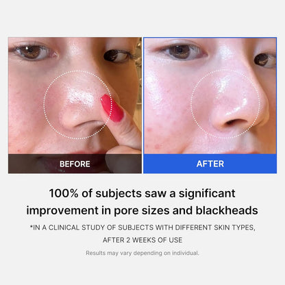 MEDICUBE Zero Pore Pad 155g - Glam Secret