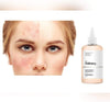 The Ordinary Glycolic Acid 7% Toning solutionGlam Secret