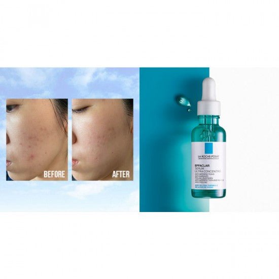 la roche posay effaclar serum ultra concentrate 30mlSerumGlam Secret