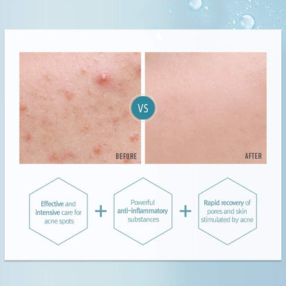 Pyunkang Yul Acne Spot Cream 15mlEYE CREAMGlam Secret